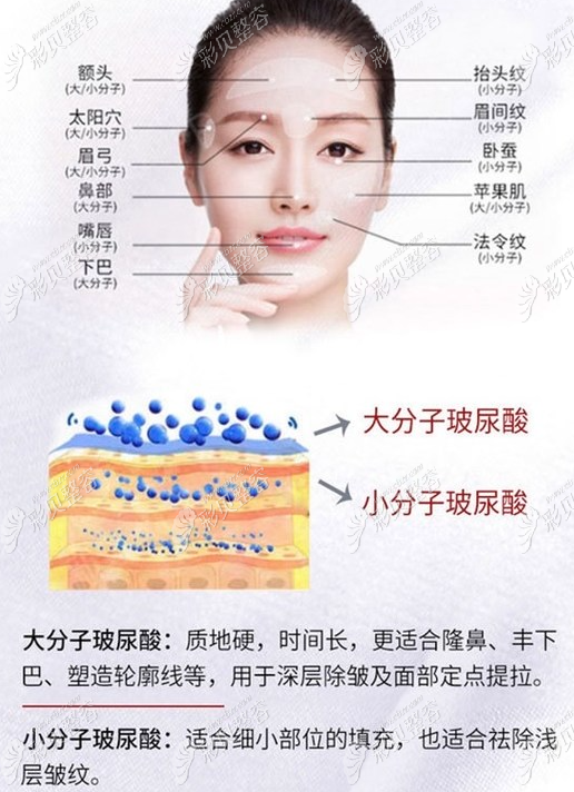 玻尿酸的作用與功效，深入了解玻尿酸的奧秘，玻尿酸的作用與功效揭秘，深入了解玻尿酸的神奇之處