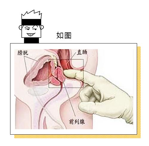 前列腺按摩手法與位置指南，全面解析與實(shí)踐，前列腺按摩手法與位置指南，全面解析與實(shí)踐技巧