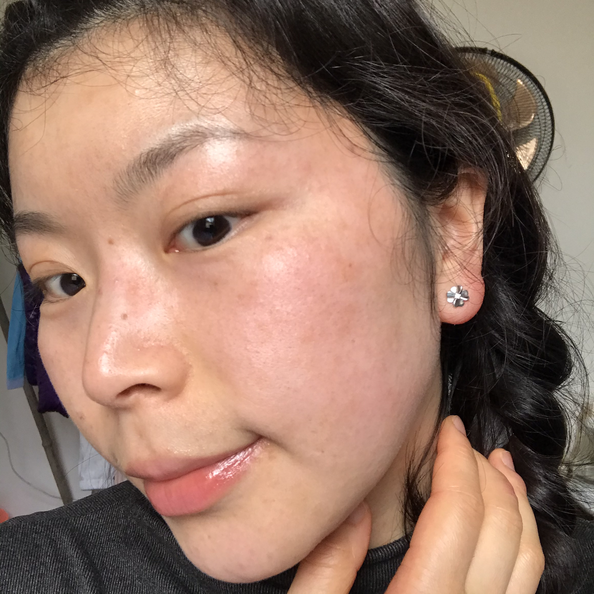 臉部過(guò)敏一般多久能自行恢復(fù)？全面解析臉部過(guò)敏恢復(fù)時(shí)間因素，臉部過(guò)敏恢復(fù)時(shí)間解析，多久能夠自行緩解？