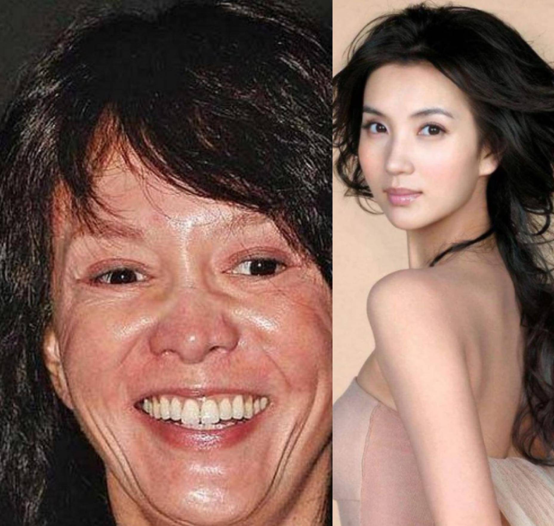 最早整容的明星，揭秘娛樂圈的先驅(qū)者們，揭秘娛樂圈先驅(qū)明星的整容歷程