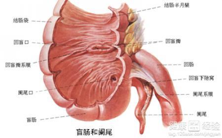 闌尾炎疼痛部位解析，闌尾炎疼痛部位詳解