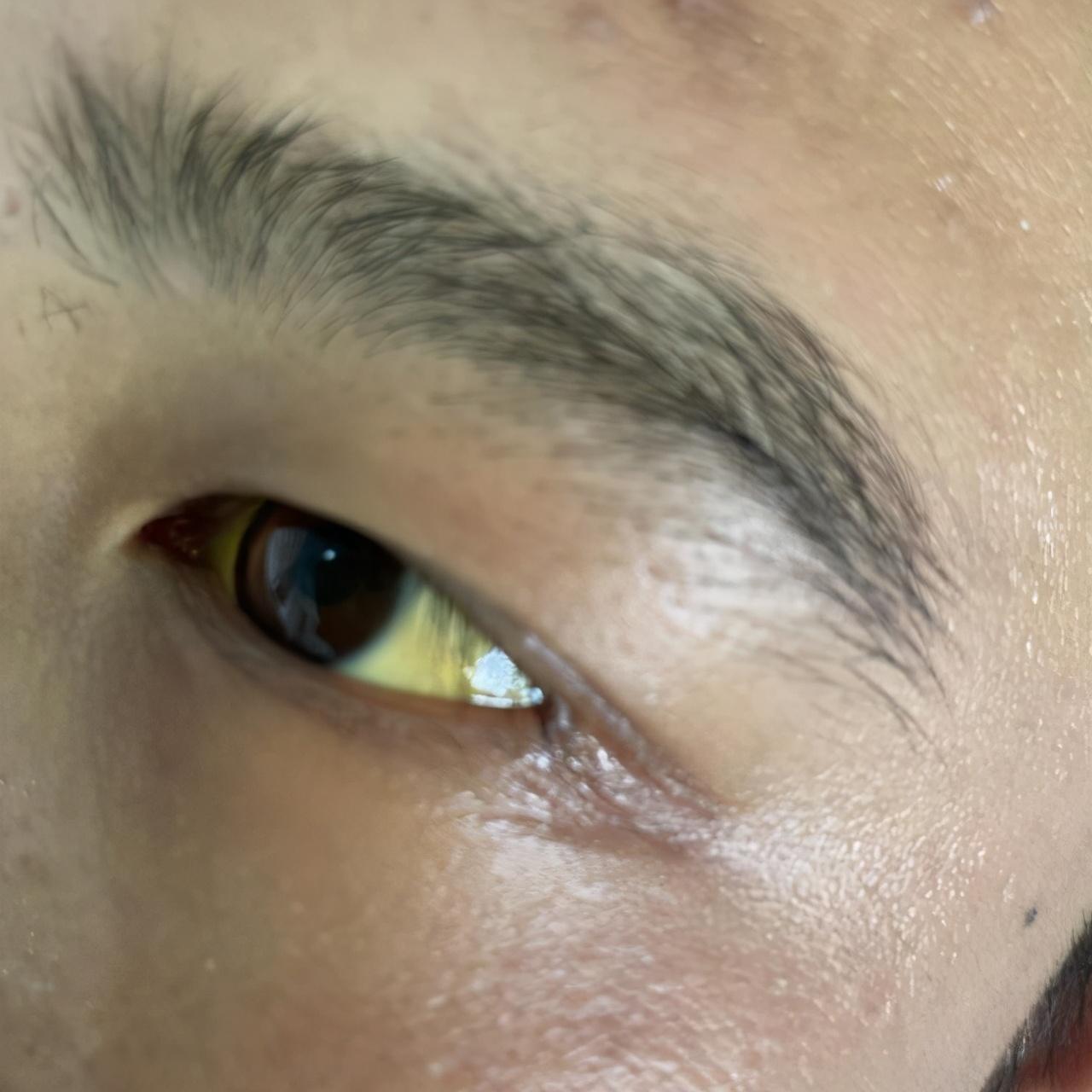 肝功能正常值參考表及其重要性，肝功能正常值參考表，揭示肝臟健康的關(guān)鍵指標及其重要性