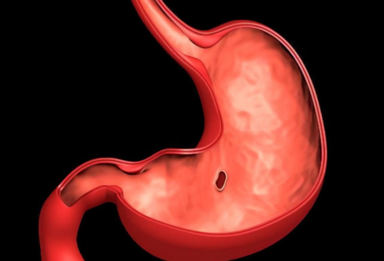 做胃鏡對(duì)胃?jìng)τ卸啻螅钊肓私馀c關(guān)注，胃鏡對(duì)胃的影響，深入了解與關(guān)注