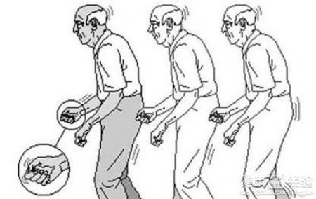 帕金森病的癥狀，深入了解與應對，帕金森病癥狀詳解及應對策略