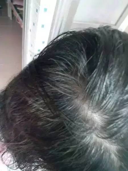 白發(fā)變黑發(fā)最快土法——自然黑發(fā)秘訣大揭秘，自然黑發(fā)秘訣，白發(fā)轉(zhuǎn)黑發(fā)最快土法大揭秘