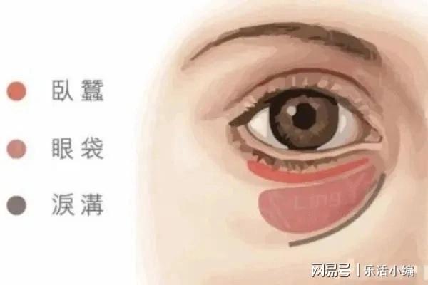 眼袋切除手術(shù)費(fèi)用詳解，價(jià)格因素與如何選擇合適的手術(shù)方案，眼袋切除手術(shù)費(fèi)用解析，了解價(jià)格因素與選擇最佳手術(shù)方案