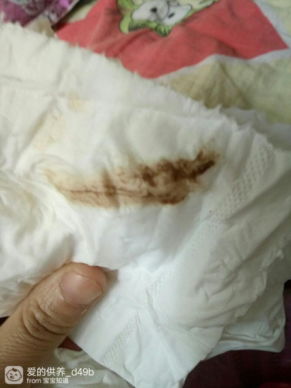 懷孕后流褐色血是好事嗎？——深入了解孕期出血真相，孕期流褐色血是好事嗎？揭秘孕期出血真相