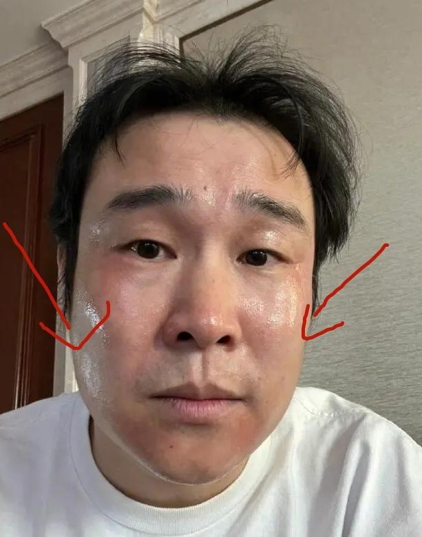 頭痛欲裂，感覺要爆炸了怎么辦？全面解析頭痛原因與應對之策，頭痛欲裂，緊急解析原因與應對之策，全面攻略助你擺脫頭痛困擾