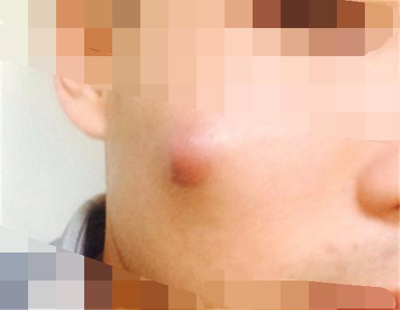 臉上一摸全是小顆粒，原因解析與應(yīng)對(duì)方法，臉部小顆粒密布，原因解析及應(yīng)對(duì)方法