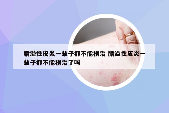 脂溢性皮炎，并非終身無法根治的疾病，脂溢性皮炎并非無法根治，治療策略助你擺脫困擾